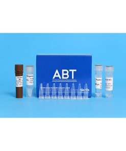 TopSPEC® HPV qPCR KIT (SQS-162)